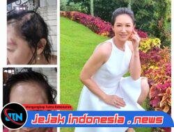 Sherly Chebing Bangkit dari Trauma, Menjadi Suara bagi Korban Kekerasan