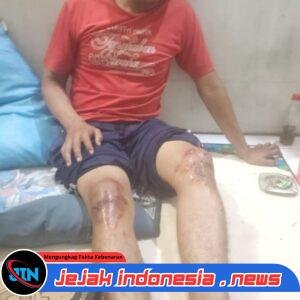 Penanganan Kasus Trisna Ginting Dinilai Janggal, Publik Desak Kapolda Sumut Bertindak