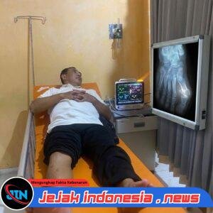 **Hasil Rontgen SHN Patah Tulang, Direktur PT. BIY Terancam Pasal Penganiayaan Berat**