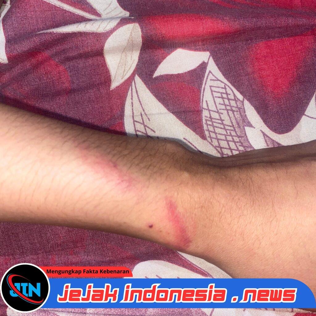 Diduga Jadi Korban Penganiayaan, Seorang Wanita di Kos Bulusan Kalipuro Alami Luka Memar, Pelaku Juga Disebut Terlibat Narkoba