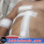 7 Peluru Bersarang di Tubuh AS! Keluarga dan PH Desak Polda Sumut Ungkap Dalang Penyerangan