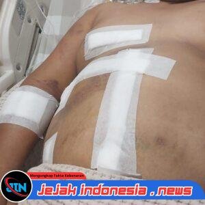 7 Peluru Bersarang di Tubuh AS! Keluarga dan PH Desak Polda Sumut Ungkap Dalang Penyerangan